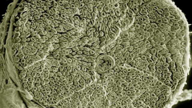 A scanning electron micrograph of a section through a human spinal nerve.